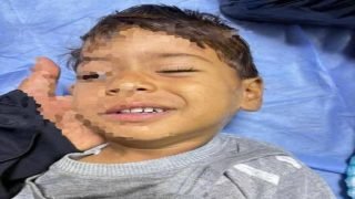 في حالة نادرة”.. طفل بعمر 3 سنوات يتعرض لجلطة دماغية بعد ان كان يعاني من ارتفاع في درجة حرارته، في محافظة النجف الاشرف.