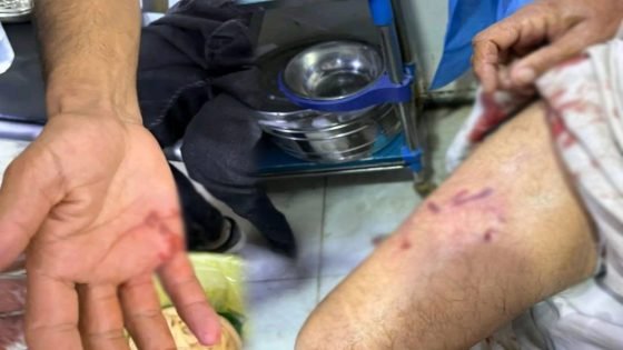 “بينهم أطفال”.. إصابة 7 أشخاص بجروح مختلفة بعد تعرضهم لهجوم من كلاب سائبة في قضاء الحمزة الشرقي جنوبي الديوانية.