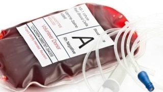 “في خبر مبشر لمرضى الكلى حول العالم”.. علماء من كندا والصين يُعلنون عن نجاحهم في تطوير “كِلية عالمية” بالإمكان نظرياً زراعتها لأي مريض مصاب بفشل كلوي أو يعاني من مشاكل في الكلى بصرف النظر عن فصيلة دمه.