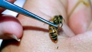 مستحضرات العناية بالبشرة تشهد طفرة جديدة مع دخول سمّ النحل ميدان مكافحة الشيخوخة ونتائج سريرية تؤكد فعاليته في تعزيز الكولاجين وشدّ البشرة