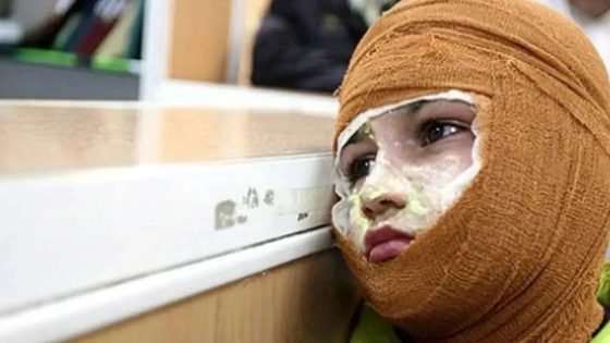 الصحة الإيرانية: عمّال البناء الأكثر تعرّضاً للصعق الكهربائي و150 ألف إصابة بالحروق سنوياً