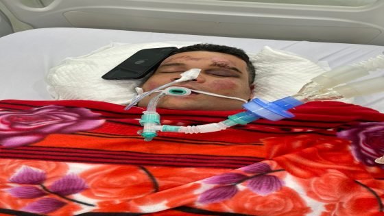 عراقي في فيتنام ماذا لو كان سعوديا، أو إماراتيا؟ شاب عراقي يتعرض لحادث سير ويصاب برأسه ويفقد الوعي 