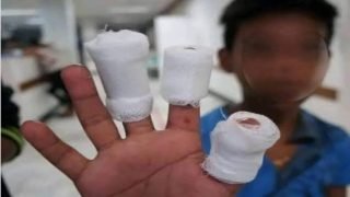 الصحة تعلن تسجيل نحو 500 إصابة في ليلة رأس السنة