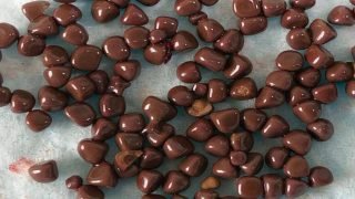 استخراج أكثر من 100 حصاة من كلية مريض عمره 35 عاماً في محافظة النجف الأشرف.