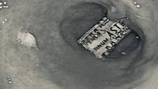 فريق طبي ينجح باستخراج “موس حلاقة” من معدة مريض يبلغ من العمر 30 عاماً في بغداد.